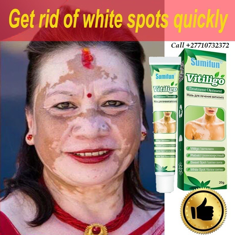 Get Rid Of Vitiligo In Colonia Municipality in the Federated States of Micronesia Call +27710732372 Tattoo Removal Oil In Yellow Springs In Ohio