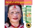 get-rid-of-vitiligo-in-colonia-municipality-in-the-federated-states-of-micronesia-call-27710732372-tattoo-removal-oil-in-yellow-springs-in-ohio-small-0